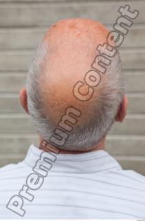 Old man bald head 0014